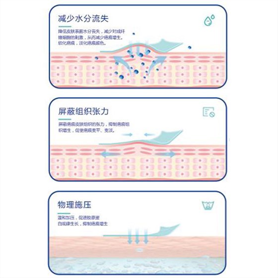 疤痕贴作用原理